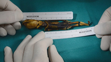 Ekspert: zagadkowa mumia z Chile nie była istotą pozaziemską