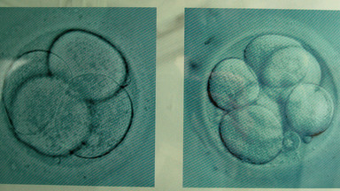 Program in vitro w Krakowie przedłużony na kolejne lata