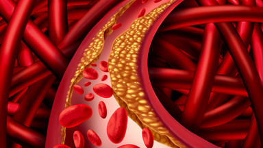 Złota czwórka, która obniży cholesterol