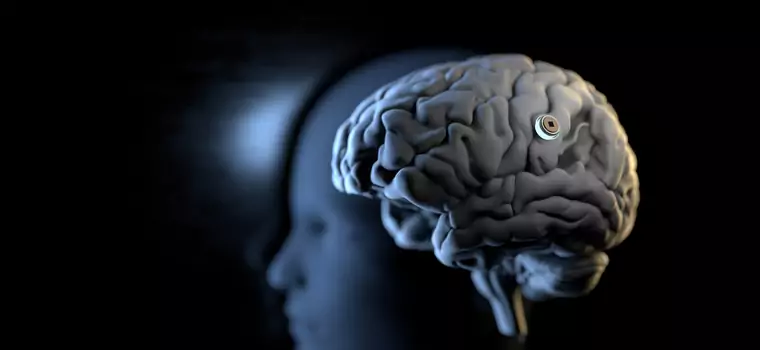 Pierwszy pacjent z Neuralink steruje komputerem myślami i... gra w Cywilizację