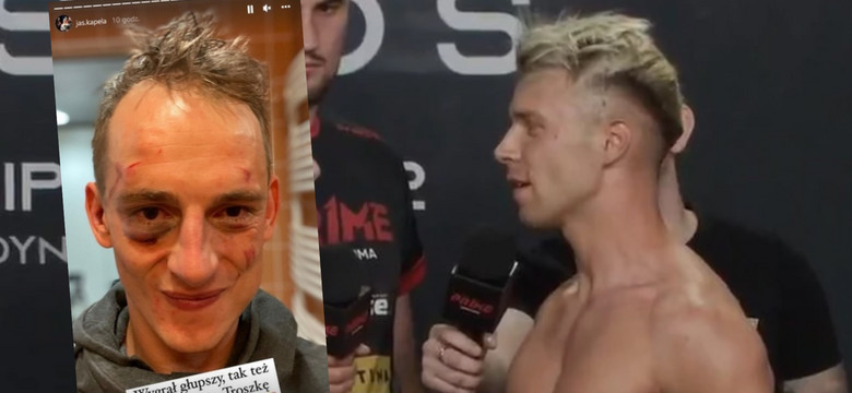 Jaś Kapela pokazał twarz po walce MMA. "Troszkę boli"