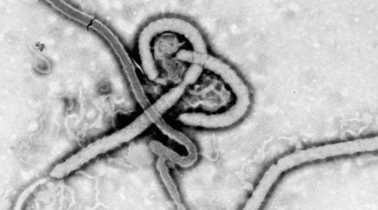 Belélegezhető vakcinával kísérleteznek az ebola ellen