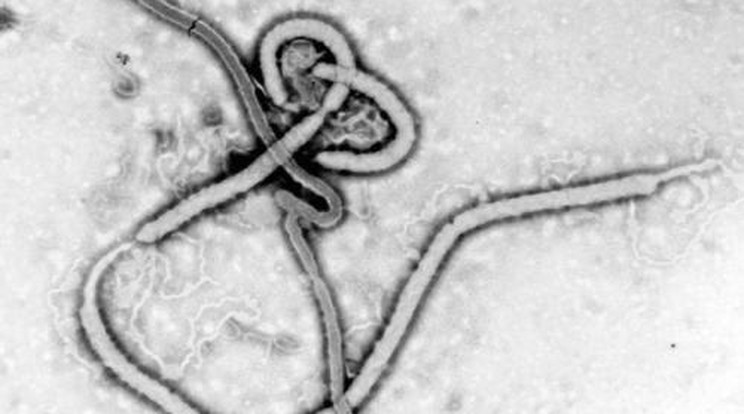 Embereken kezdenek tesztelni egy ebola elleni oltóanyagot