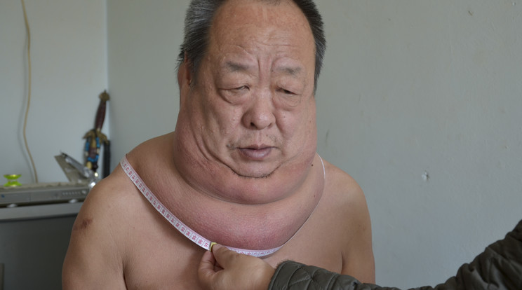 Mr.Wang nyaka egyre nagyobbá vált /Fotó: AFP