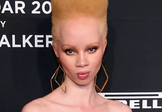 Afrykańska modelka, która jest albinoską, pierwszy raz pojawiła się na okładce "Vogue'a"