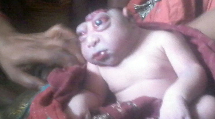 Torz UFO babát hozott a világra egy indiai nő/Fotó: Northfoto