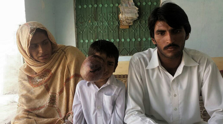 Ennek a hétéves pakisztáni fiúnak a szülei remélik, fiuk egyszer normális életet élhet /Fotó: Profimedia-Reddot