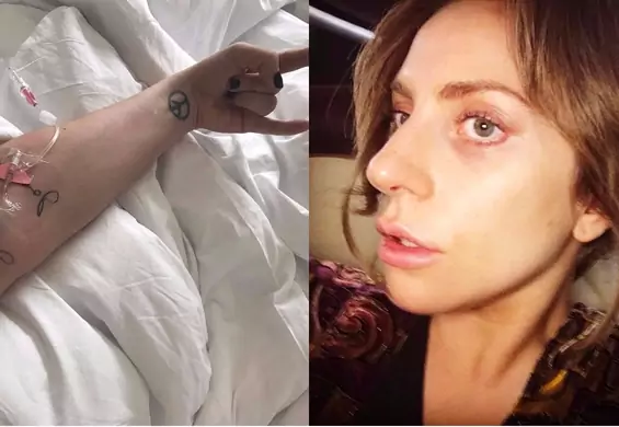 Lady Gaga przyznała się do nieuleczalnej choroby. Gwiazda odwołała już pierwszy koncert