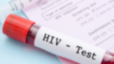 Życie z HIV może być dobre. Ruszają kolejne ogólnopolskie badania