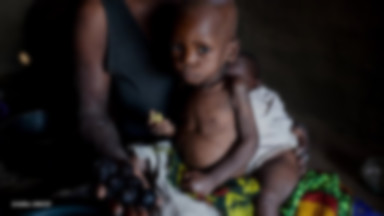 95 milionów dzieci cierpi przez głód. Skutki są tragiczne
