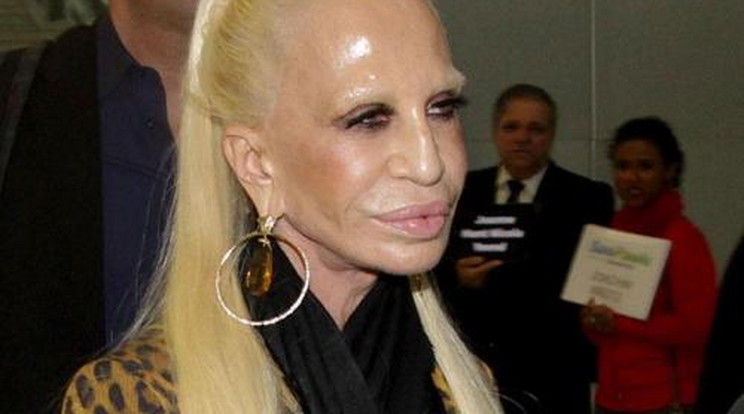 Ijesztő! Így torzult el az évek alatt Donatella Versace arca