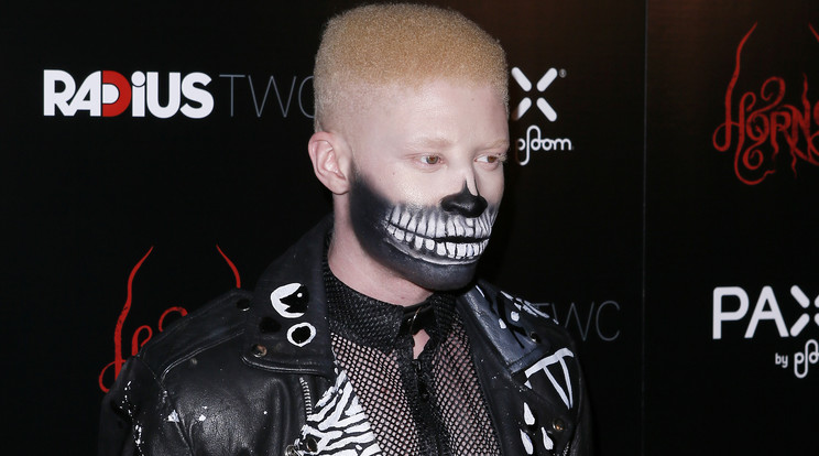 Shaun Ross, a leghíresebb albínó modell / Fotó: Northfoto