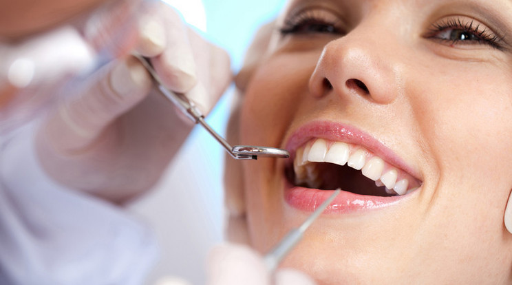 A következő szabályokkal megőrizhetjük fogaink egészségét és szépségét /Fotó: Thinkstock