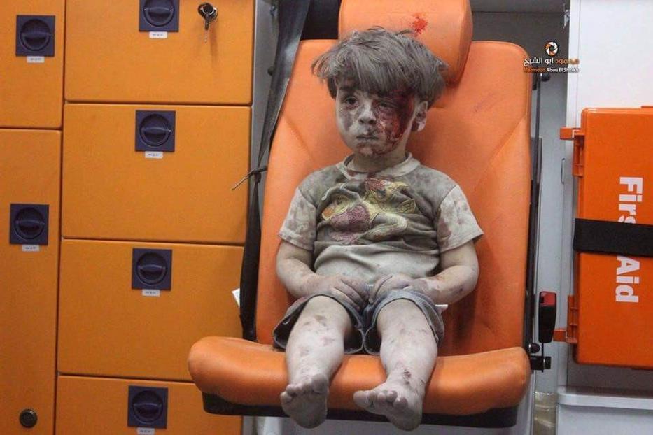 Rengeteg gyerek szenved a bombázások miatt