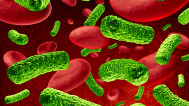 Sepsa a bakteriemia - czym się różnią