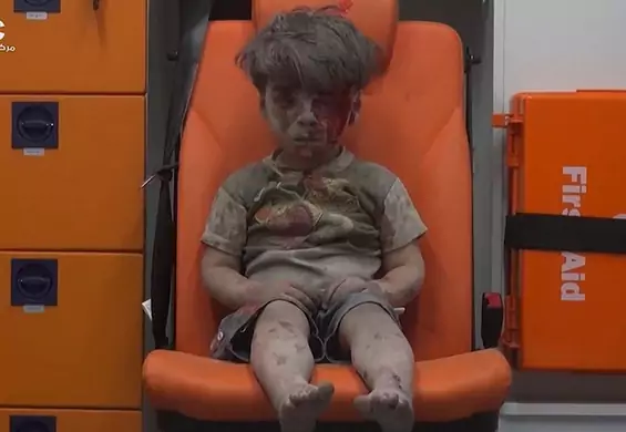 Pielęgniarka, która pomogła chłopcu z Aleppo, apeluje: te dzieci nie mają nic wspólnego z tą wojną