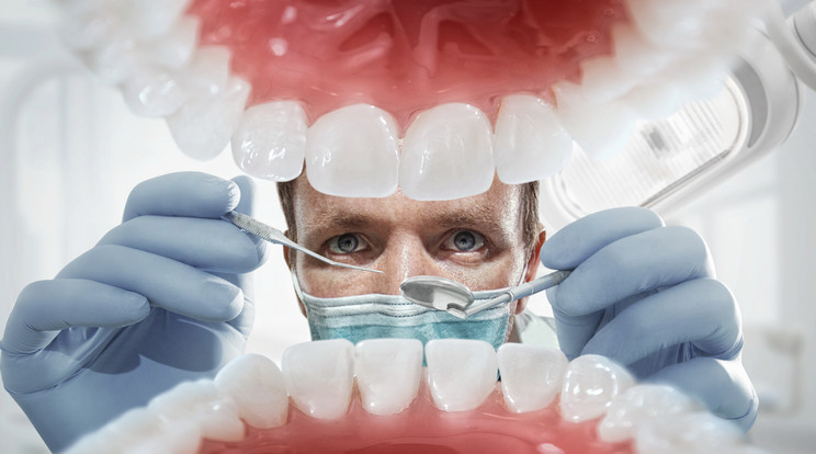 Veszélyes a fogorvosok élete/Fotó:Shutterstock