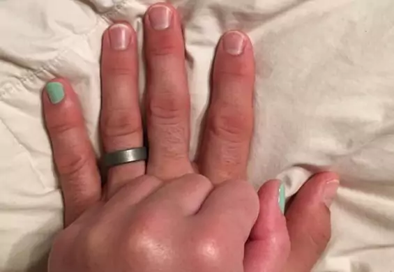 Mężczyzna pomalował sobie mały palec u dłoni, żeby… pomóc kalekiej żonie zapozować do zdjęcia