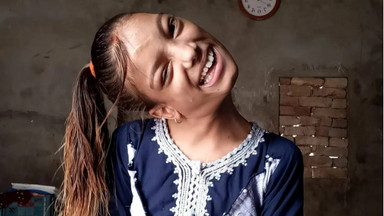 Gdy miała 10 miesięcy, siostra wypuściła ją z rąk. Po 13 latach lekarz z Indii pomógł jej odzyskać sprawność