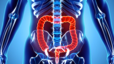 Polipy jelita grubego - towarzyszą im uporczywe gazy, biegunki i krwawienia z odbytu. Leczenie choroby