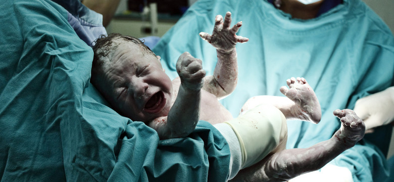 Jak wygląda noworodek zaraz po porodzie?
