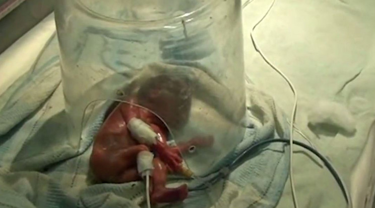Hamvasztani akarták a babát, mert nővérek halottnak hiték /Fotó: YouTube Grebb