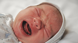 Ciemieniucha u niemowlaka - przyczyny, leczenie. Jak się pozbyć ciemieniuchy? [WYJAŚNIAMY]