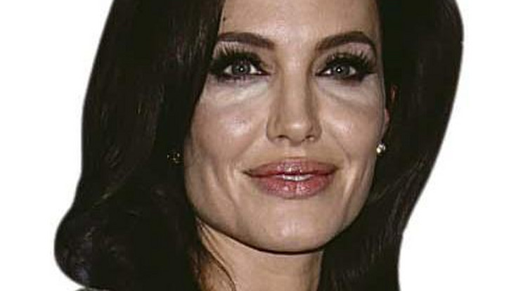 Óva intenek az orvosok Angelina Jolie példájától