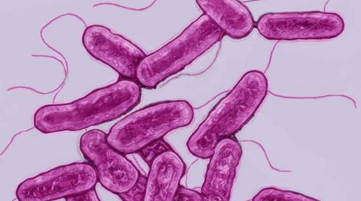 Vészhelyzet! Légiós baktériumot találtak a pécsi klinikán