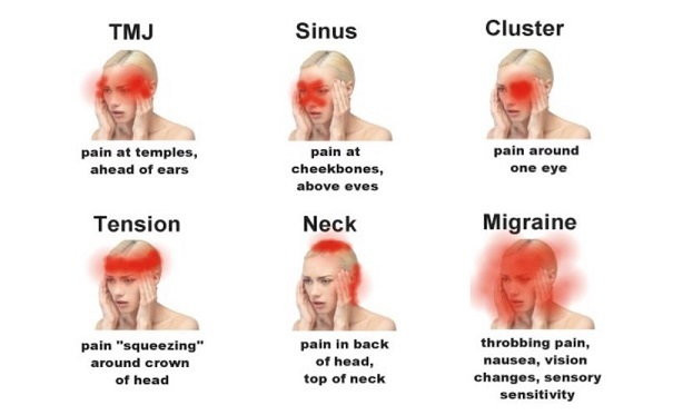 Nie bagatelizuj bólu głowy