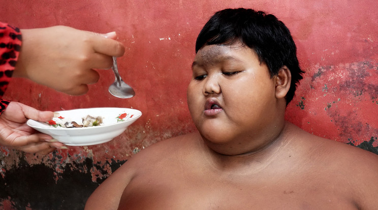 Napjában már csak 
kétszer ehet a fiú, hogy leadjon a tetemes súlyából/Fotó:Northfoto