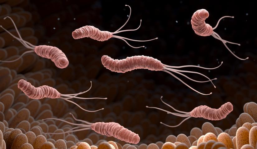 Sok sav és gyomorrák: vígan elél a gyomorban a baktérium, ami ezeket okozza