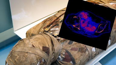 Pierwsza na świecie mumia ciężarnej kobiety. Odkrycie polskich naukowców