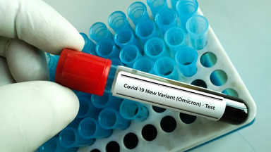Opolskie apteki rezygnują z robienia bezpłatnych testów antygenowych na COVD-19