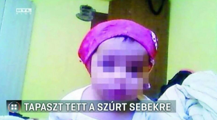 A kislányt egy 21 centis késsel szúrta le drogos apja, az orvos mégis horzsolásnak nézte a szúrt sebet / Fotó: RTL Klub