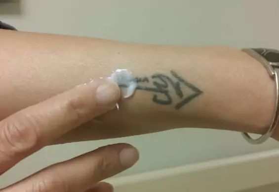 Zobacz, jak działa krem do bezbolesnego usuwania tatuaży. Laser idzie w zapomnienie