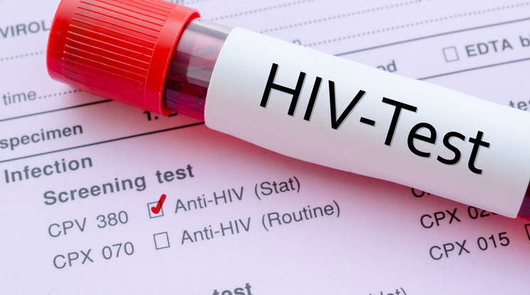 Évente háromszázzal nő a HIV fertőzöttek száma hazánkban / Illusztráció: Northfoto