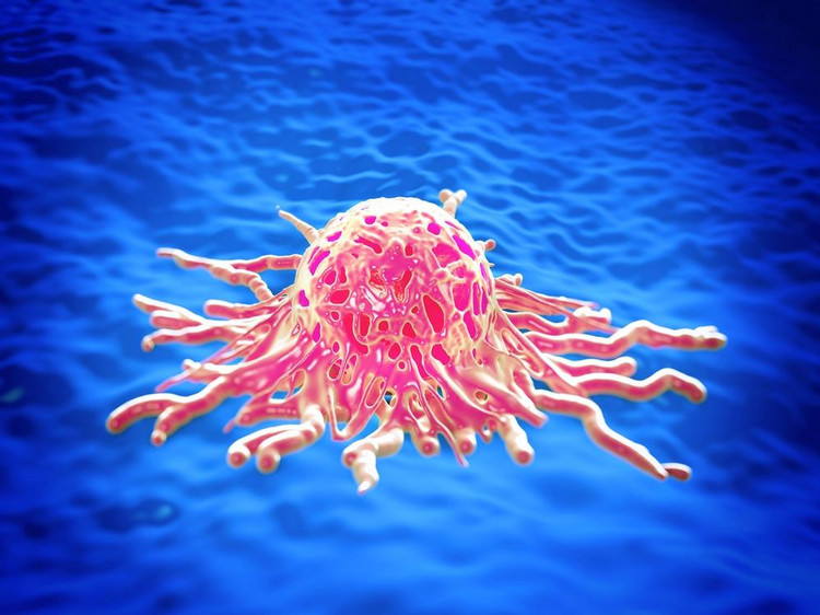 Jaka jest skuteczność leczenia raka trzustki?
