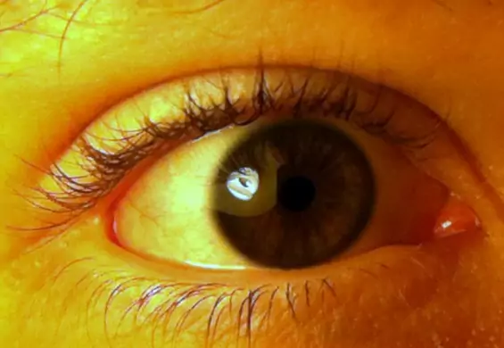Tajemnicza różowa kulka w kąciku oka – czym jest i do czego służy?