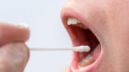 Przewlekłe wrzodziejące zapalenie  jamy ustnej - przyczyny, diagnostyka, leczenie