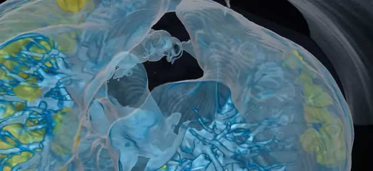 Dzięki VR można zobaczyć, jak od środka wyglądają płuca zniszczone przez koronawirusa