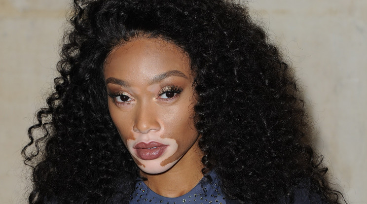 Winnie Harlow a Dior modellje / Fotó: Northfoto