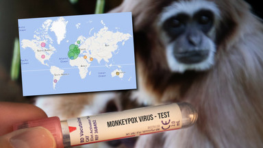Małpia ospa coraz bliżej Polski. Pierwszy przypadek w Czechach, Niemcy kupują szczepionki