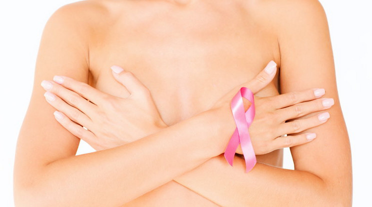A mellrák kialakulásának esélyét csökkentheti a rendszeres testmozgás /Illusztráció: Shutterstock
