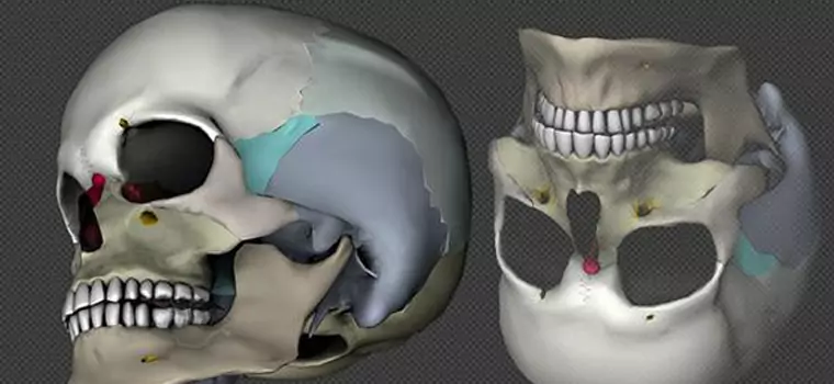 Irlandczycy wynaleźli nową metodę druku 3D chrząstek do implantów