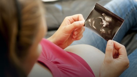 Buduće majke abortiraju kada smatraju da imaju opravdan razlog 