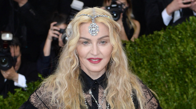 Madonna nem veti meg a plasztikai műtétet /Fotó: Northfoto