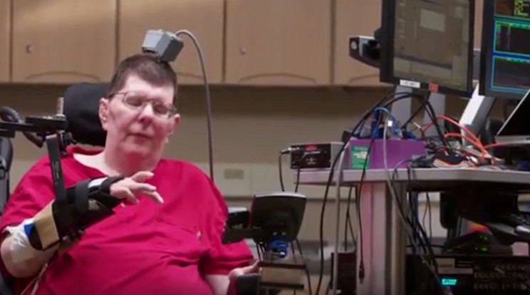 Bill Kochevar nyolc éve,
kerékpárbalesetben bénult
le, forradalmi szerkezet segítségével mozgathatja
újra a kezét