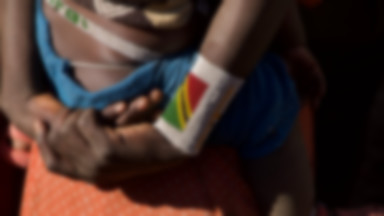 Zambia: Niezwykły przypadek medyczny. Chłopiec nie może otworzyć oczu