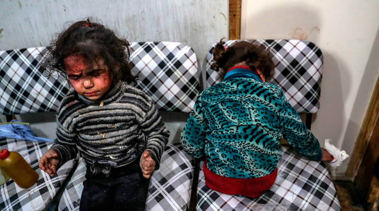 Sebesült gyermekek Kelet-Gúta kórházában / Fotó: MTI